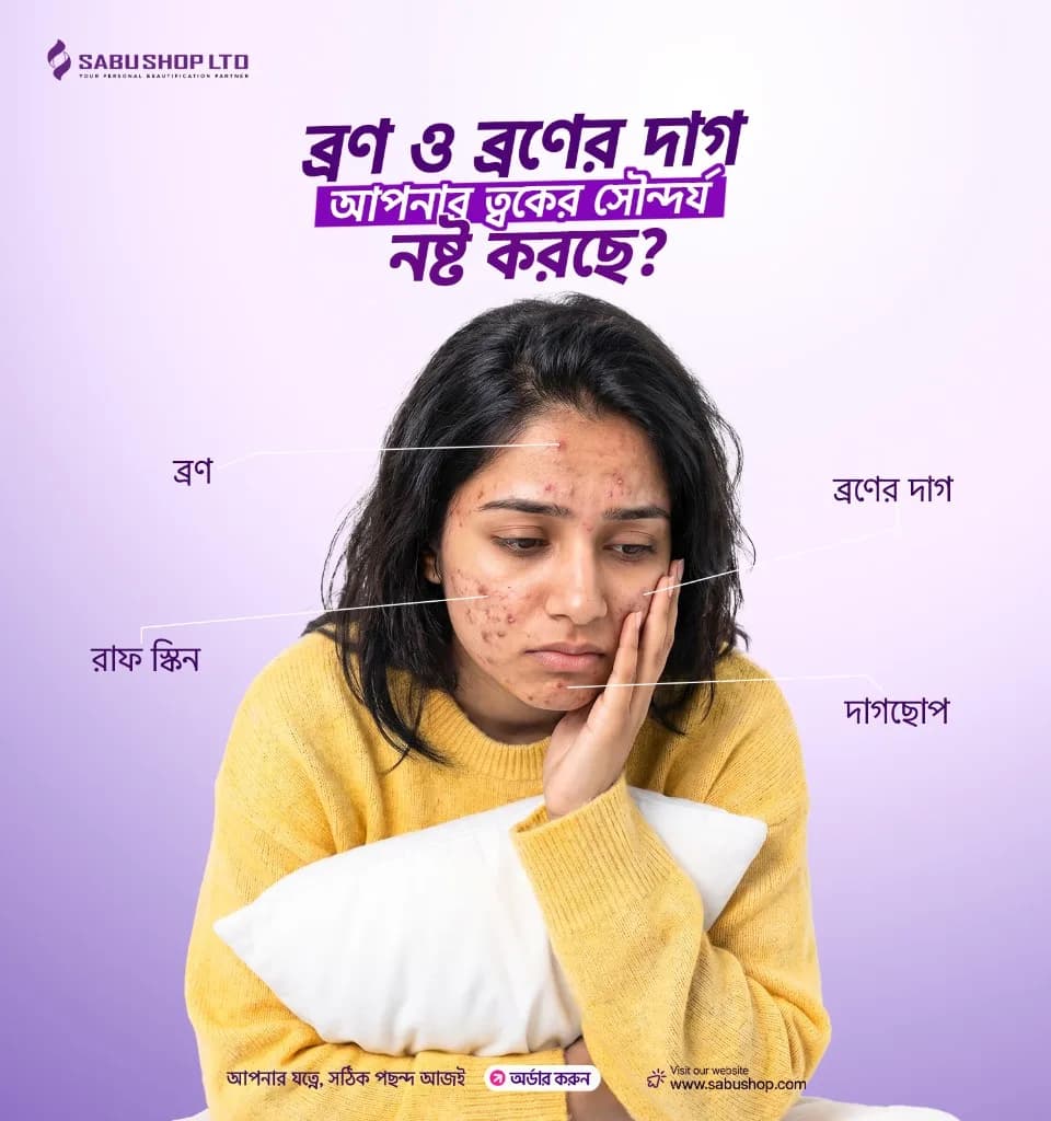 ব্রণ, ব্রণের দাগ, রাফ স্কিন ও দাগছোপ